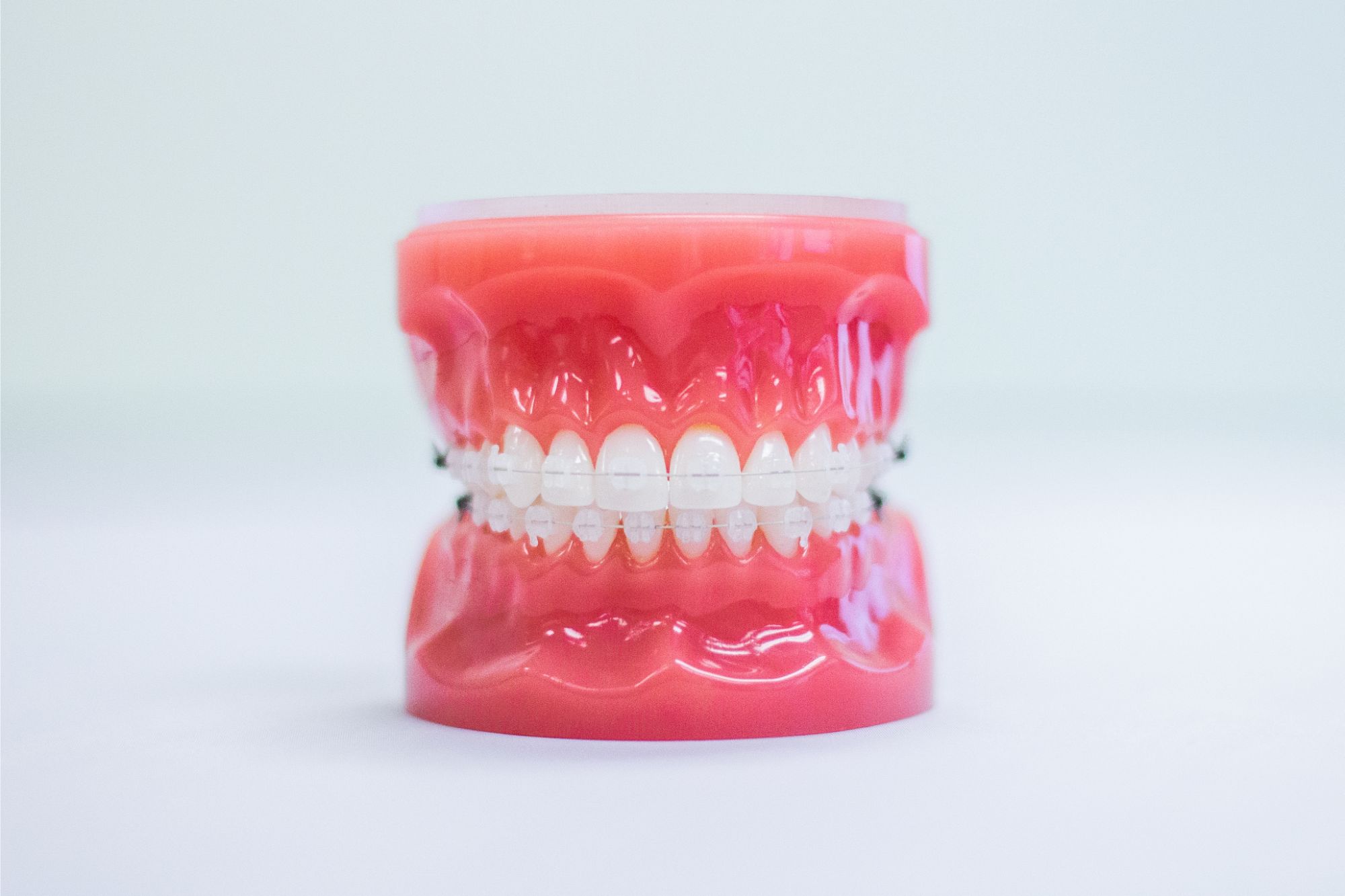 Are There Clear Braces Options? - Brimhall Dental Group